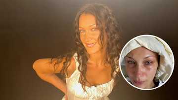 Bella Hadid, muling isinugod sa ospital dahil sa Lyme disease