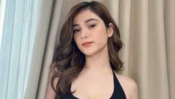 Umano'y photos ni Debbie Garcia matapos ang physical altercation nila ni Barbie Imperial, viral