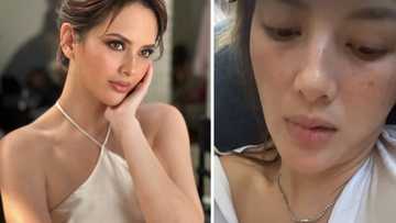 Ellen Adarna, ibinahaging nagkasakit, migraine bumalik: "I'm dead inside"