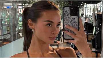 Kylie Verzosa, inilahad ang cosmetic procedure na pinagsisisihan niya