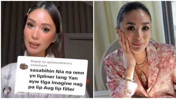Heart Evangelista recalls lip fillers mishap: “I was super traumatized”