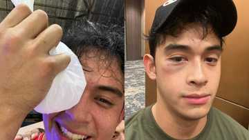 Diego Loyzaga, ipinakita ang naging "souvenir" niya mula sa basketball game