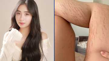 Bea Borres, nagbahagi ng totoong pakikibaka sa post-pregnancy body niya