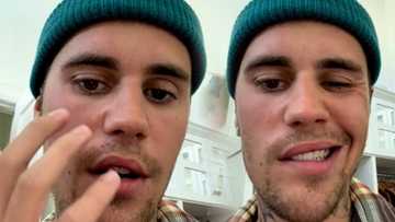 Justin Bieber, dumanas ng face paralysis kaya nakansela umano ang mga shows