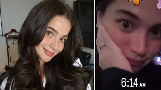 Anne Curtis, ibinahagi ang problemang pinagdaanan bago ang 'Magpasikat' performance