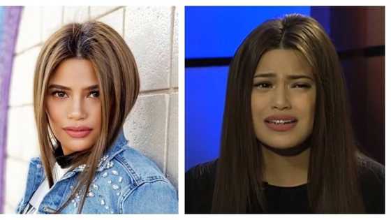 Mahilig ka ba mag-puyat? Denise Laurel raises awareness on the bad effects of lack of sleep “I have cysts all over!”