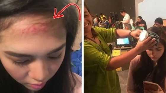 Janella Salvador naaksidente sa shooting. Elmo Magalona alalang alala!