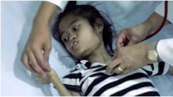 17 anyos na dalaga, buto't balat na dahil sa malubhang karamdaman