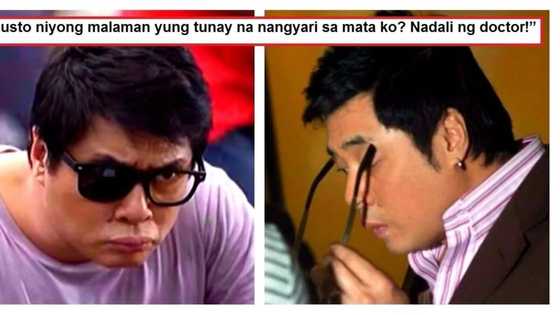 Randy Santiago reveals the heartbreaking true story behind his damaged left eye! Nakakaawa naman siya!