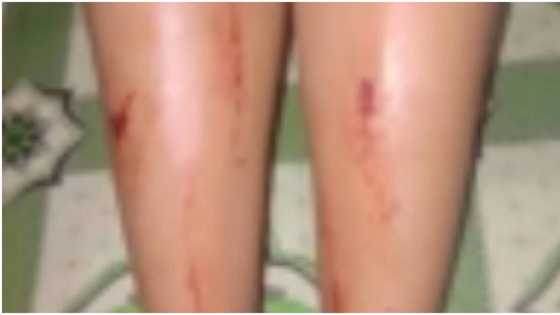 Babae sa Negros Oriental, kinalmot daw ng aswang sa loob mismo ng boarding house