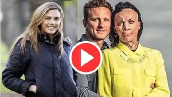 VIDEO: This model suffered severe BURNS; but what her boyfriend did will melt your heart