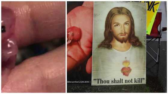 Woman Takes Abortion Pill, Sees Her 7-Week-Old Baby