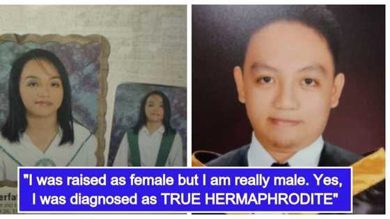 Binata na pinalaki at namuhay na isang babae, 16 na taon bago nakumpirma na isa pala talaga siyang lalaki