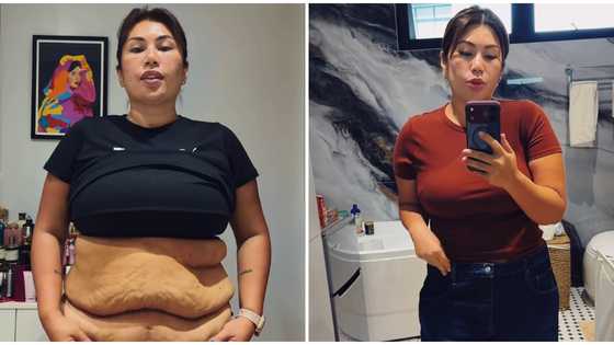Eric ‘Eruption’ Tai’s wife undergoes cosmetic surgery after weight loss