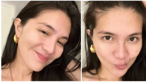Dimples Romana captivates netizens with her no-make up selfies