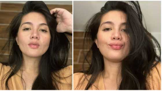 Dimples Romana, nagbahagi tungkol sa kanyang pagbubuntis: "my hormones are kicking in"