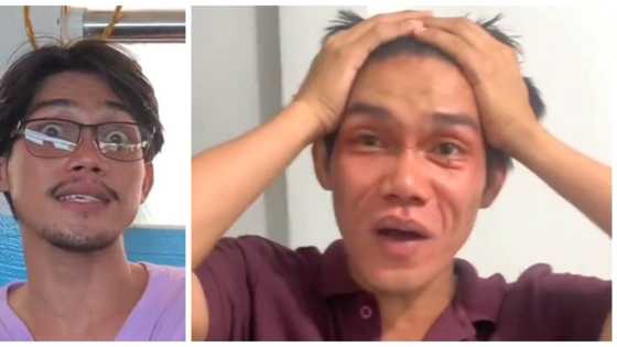 Content creator, umano'y na-trauma sa nangulubot na mukha dahil sa facial mask