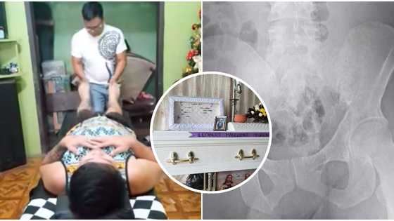 Lalaking umano'y nabalian dahil sa chiropractic session, pumanaw na