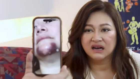 Rufa Mae Quinto, ibinahagi ang near-death experience sa Amerika