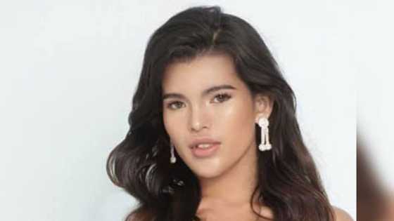 Before-and-after transformation ni Ms. Everything, viral na; 8 cosmetic procedures ang isinagawa