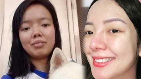 Rosmar Tan, ibinida din ang kanyang version ng "before and after" pictures