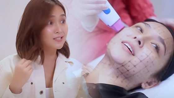 Kathryn Bernardo, prangkang sinagot ang mga tanong tungkol sa cosmetic surgery rumors