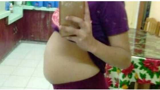Babae, ibinahagi sa social media ang dahilan ng abnormal na paglaki ng kanyang tiyan