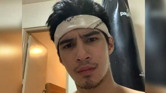 Albie Casiño, sinabing nawalan siya ng millions dahil sa isyu noon kay Andi Eigenmann