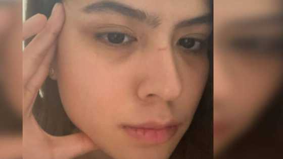 Alexa Ilacad, bongga ang resbak sa rude bashers na inakusahan siyang nagpa nose job