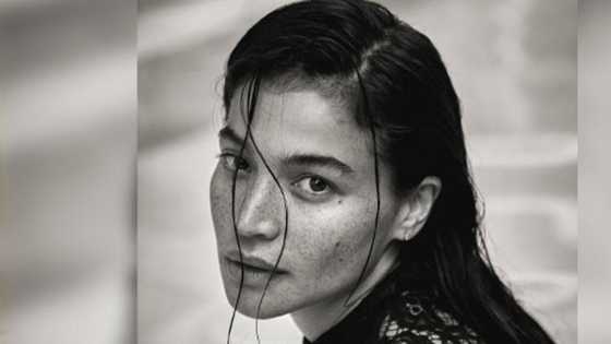 Anne Curtis, finlex ang gorgeous pics niya: “It’s been amazing so far. Freckles and all.”