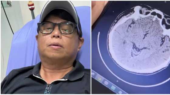 Arnold Clavio, na-ospital dahil sa stroke: “Feeling ok doesn’t mean you’re ok”