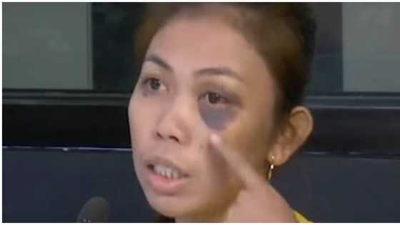 Mister na hinihingan ng sustento, black eye ang ibinigay kay Misis
