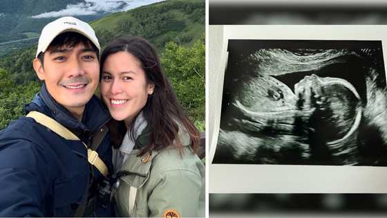 Robi Domingo, ibinahagi ang sonogram ng baby nila ni Maiqui Pineda