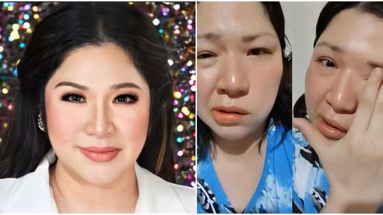 Frenchie Dy, binahagi ng saloobin matapos tamaan ng Bell's Palsy sa pangatlong pagkakataon