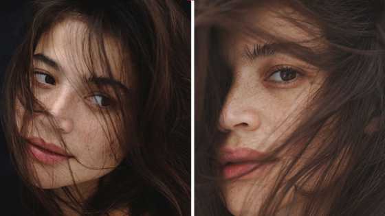 Anne Curtis, ibinida ang kanyang freckles; celebs, nag-react