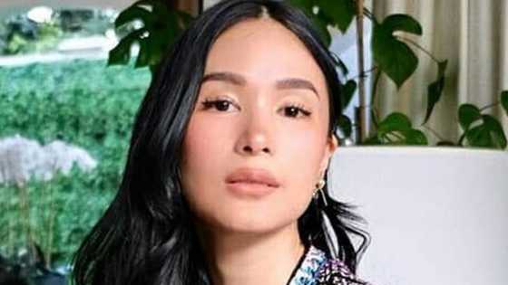 Heart Evangelista, ibinahagi ang ilang nakaka-embarrass nyang karanasan sa Paris: “I stepped on dog waste”
