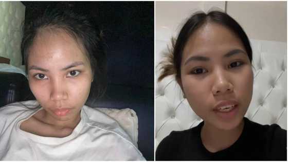 Lie Reposposa, nagbahagi ng health update matapos tamaan ng TB