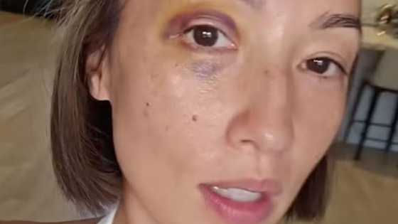 Solenn Heussaff, natawa nang magka-black eye nang tamaan ng ulo ni Maelys habang siya'y natutulog