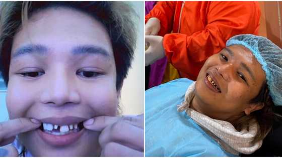 Xander Arizala, nagbahagi ng update sa kanyang dental treatment