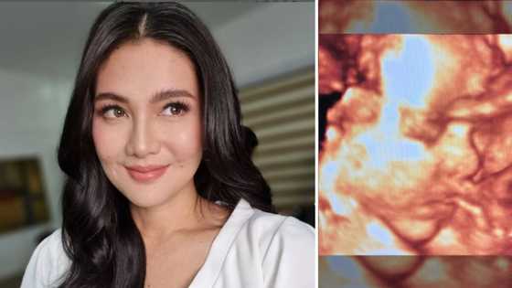 Dimples Romana shows sonogram of her baby, pens heartfelt message to her “bunso”